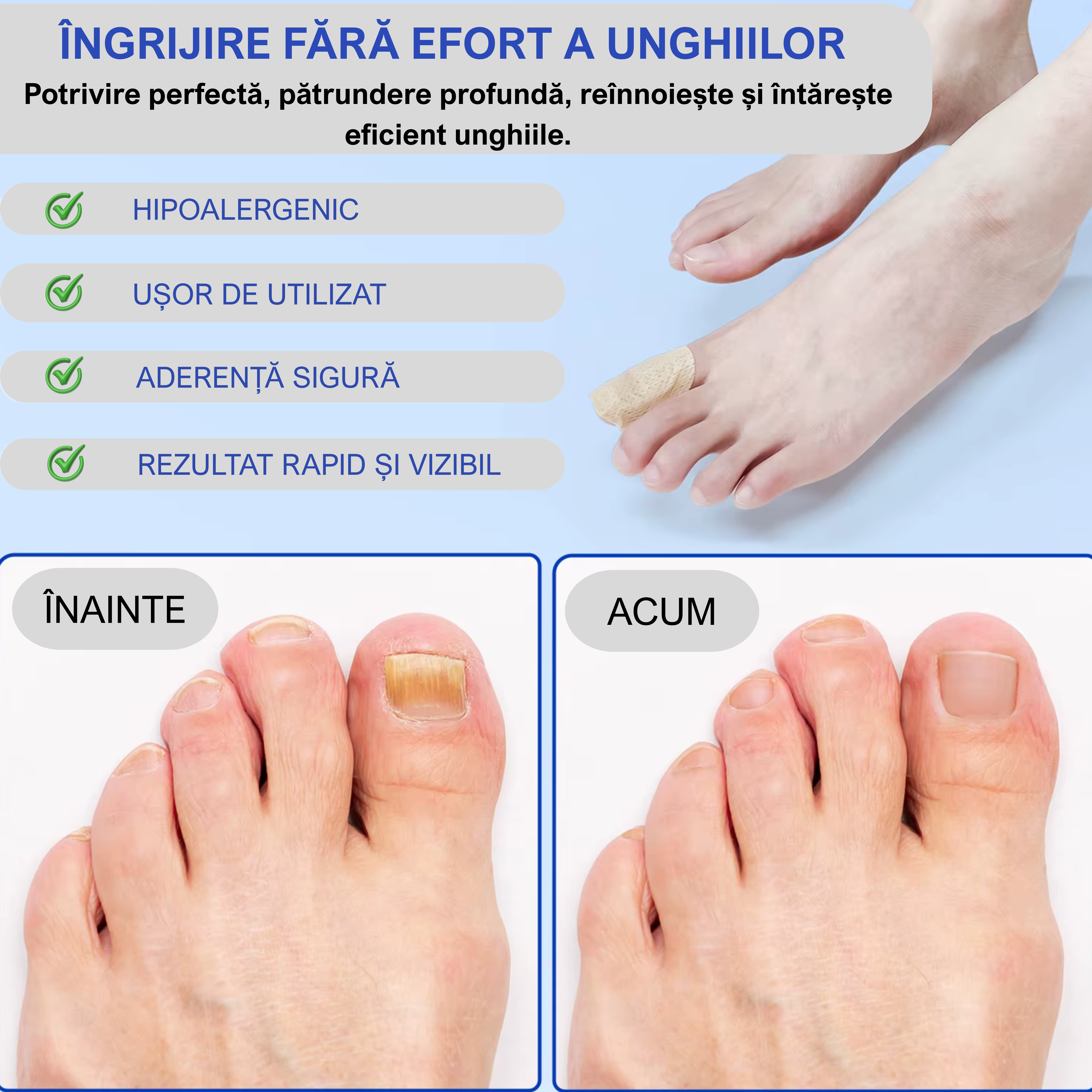 Plasturi antifungici pentru unghii