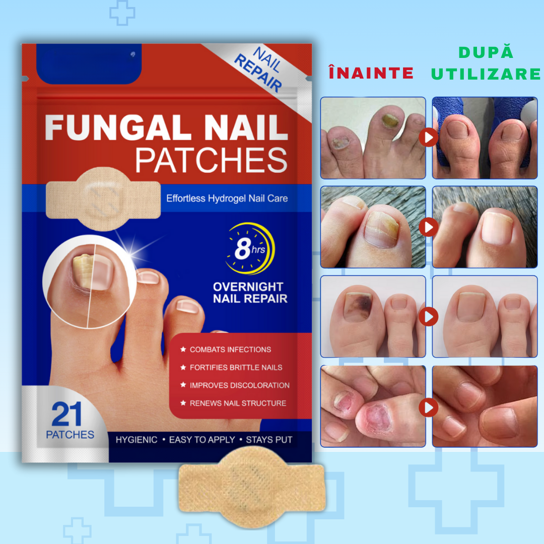 Plasturi antifungici pentru unghii